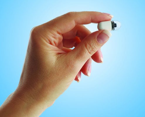 Capsule Endoscopy MedAlliance Cardiology Albury Wodonga Heart Specialist