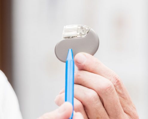 Medtronic, St Jude, Boston Scientific, Biotronik Pacemaker Check MedAlliance Cardiology Albury Wodonga Heart Specialist