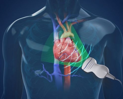 Echocardiogram MedAlliance Cardiology Albury Wodonga Heart Specialist