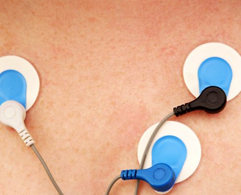 Holter Monitor MedAlliance Cardiology Albury Wodonga Heart Specialist
