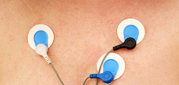 Holter Monitor MedAlliance Cardiology Albury Wodonga Heart Specialist